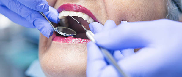 Best Knocked-Out Tooth (Avulsed Tooth) Treatment in Camden, AL